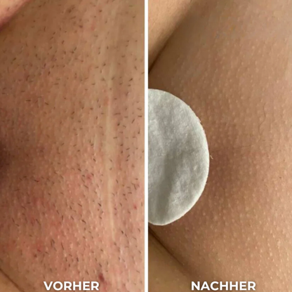 SkinGlow Elite - 2-in-1 Rasierer mit Trimmer & Epilierer